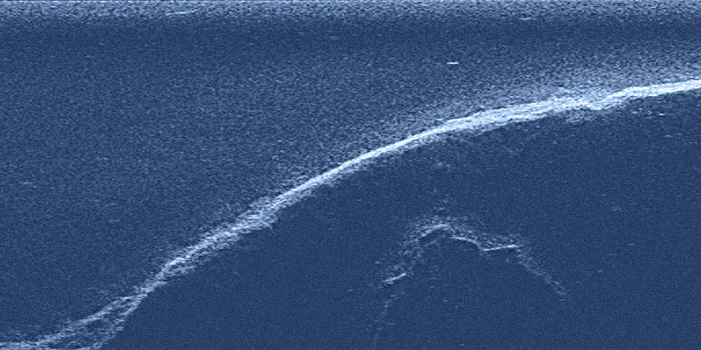 Side-scan sonar